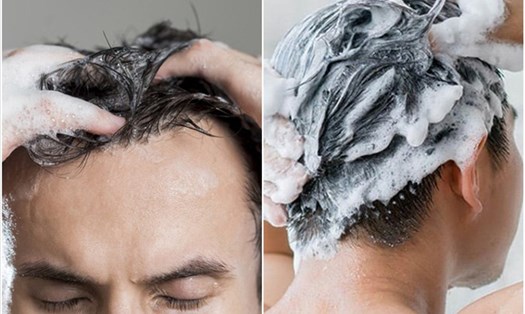 7 nguyên nhân hàng đầu làm tóc khô ở nam giới. Đồ họa: Thanh Ngọc