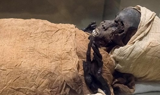 Xác ướp của Vua Ai Cập cổ đại Seqenenre-Taa-II. Ảnh: Bộ Cổ vật Ai Cập/AFP