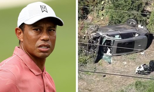 Chưa rõ mức độ chấn thương cụ thể của tay golf huyền thoại, Tiger Woods. Ảnh: Fox Sports