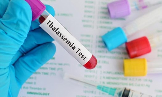 Sản phụ mắc bệnh Thalassemia cần thường xuyên kiểm tra sức khỏe để phát hiện những bất thường sớm cho mẹ và thai nhi (Hình ảnh minh họa)