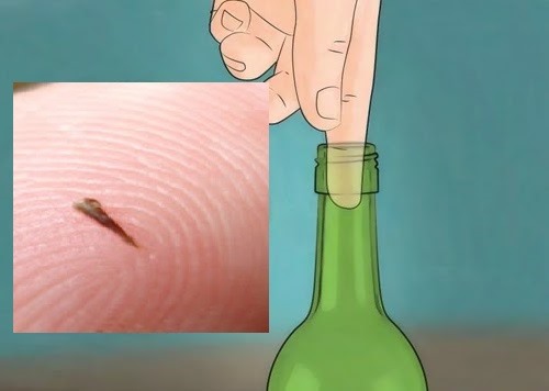 Nằm Mơ Thấy Bị Gai Đâm Vào Tay - Giải Mã Ý Nghĩa Và Điềm Báo Chính Xác