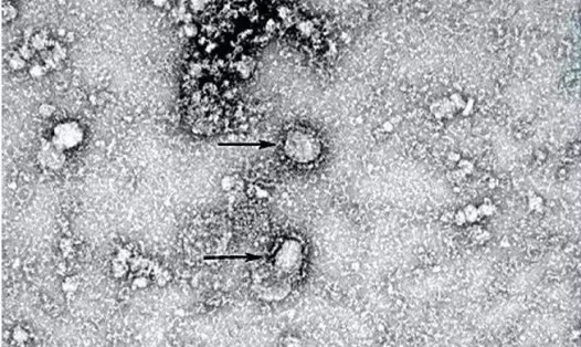 Hình ảnh virus SARS-CoV-2 chủng mới qua kính hiển vi. Ảnh: Xinhua