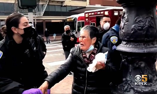 Bà cụ gốc Châu Á bị tấn công vào bên mắt trái tại phố Market, San Francisco. Ảnh: KPIX 5