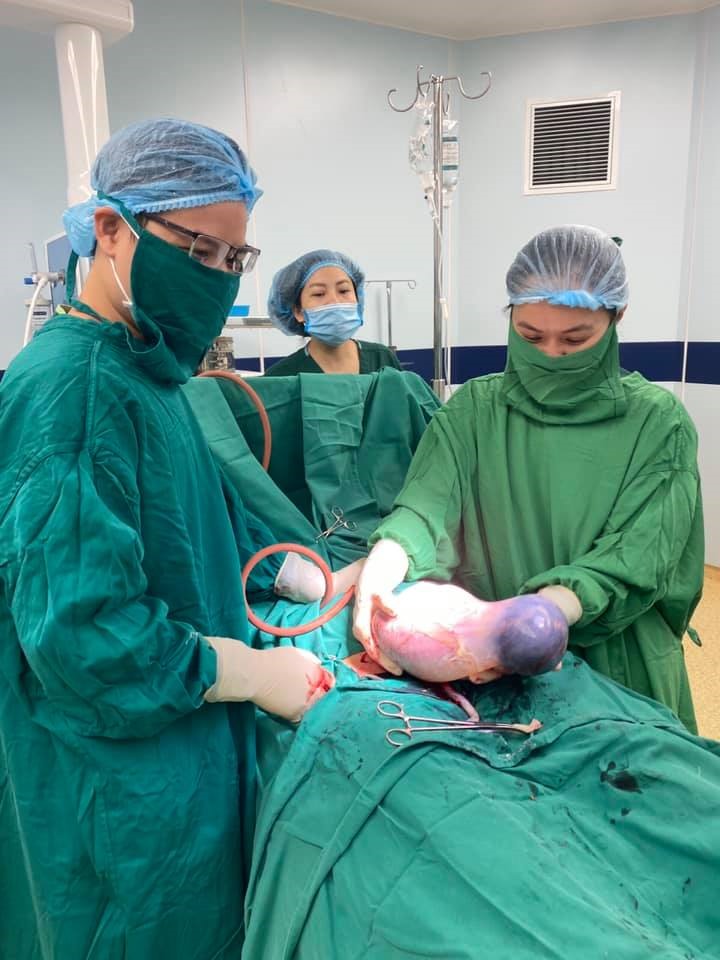 Hình ảnh bé sơ sinh nguyên trong bọc ổi khi sinh. Ảnh: BVCC