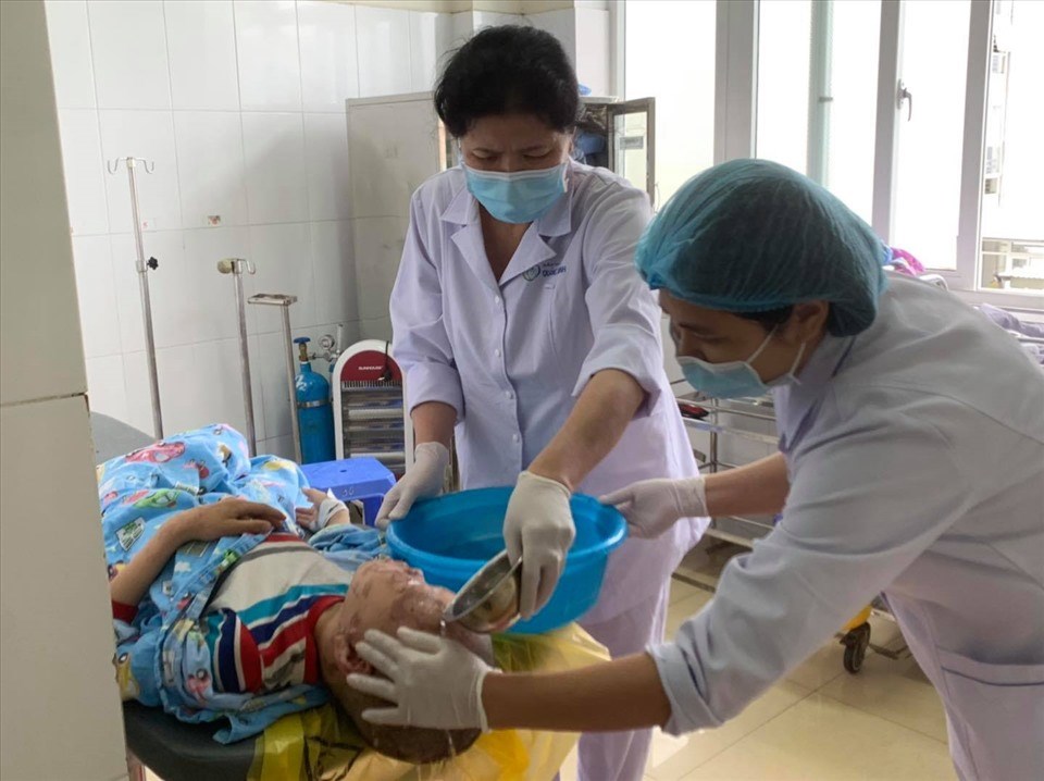 Bác sĩ sơ cứu cho bệnh nhân bị bỏng. Ảnh: BVCC Bác sĩ sơ cứu cho bệnh nhân bị bỏng. Ảnh: BVCC