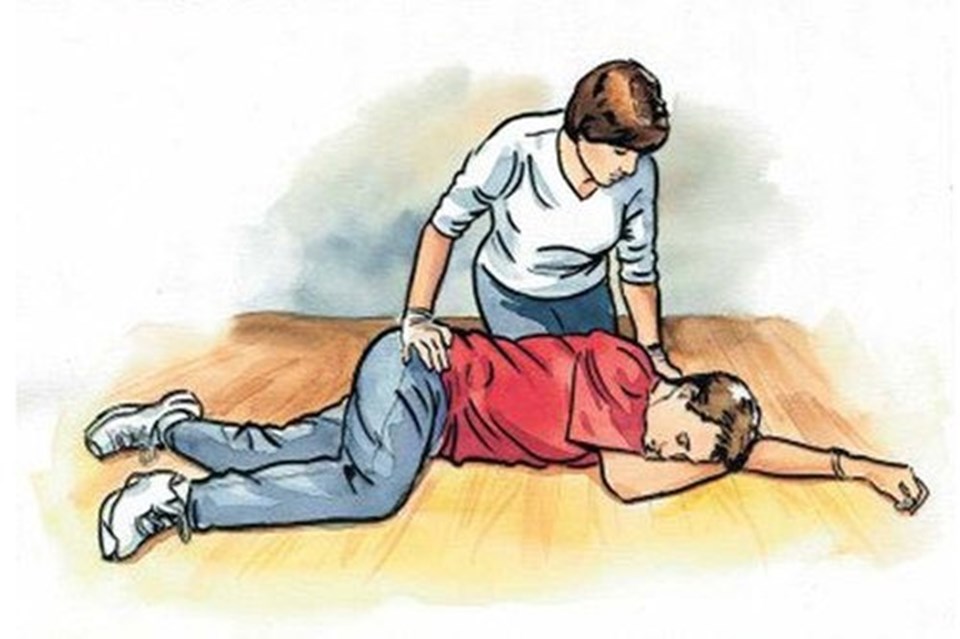 Cách sơ cứu người đột quỵ: đặt bệnh nhân nằm đầu thấp, mặt nghiêng sang một bên... Ảnh: Viện Tim mạch Việt Nam Cách sơ cứu người đột quỵ: đặt bệnh nhân nằm đầu thấp, mặt nghiêng sang một bên... Ảnh: Viện Tim mạch Việt Nam