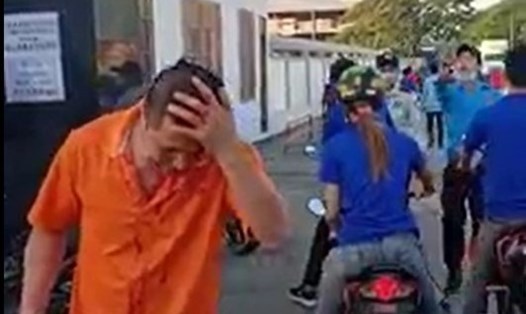 Một công nhân ở Bình Dương bị nhóm bảo vệ đánh vỡ đầu. Ảnh cắt từ video người dân cung cấp