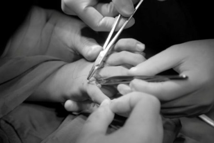 Người đàn ông bị tổn thương nghiêm trọng bàn tay trái do máy thái rau Người đàn ông bị tổn thương nghiêm trọng bàn tay trái do máy thái rau