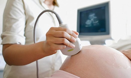 Phụ nữ mang thai cần sàng lọc tiền sản giật để phát hiện bệnh kịp thời. Ảnh: BVCC