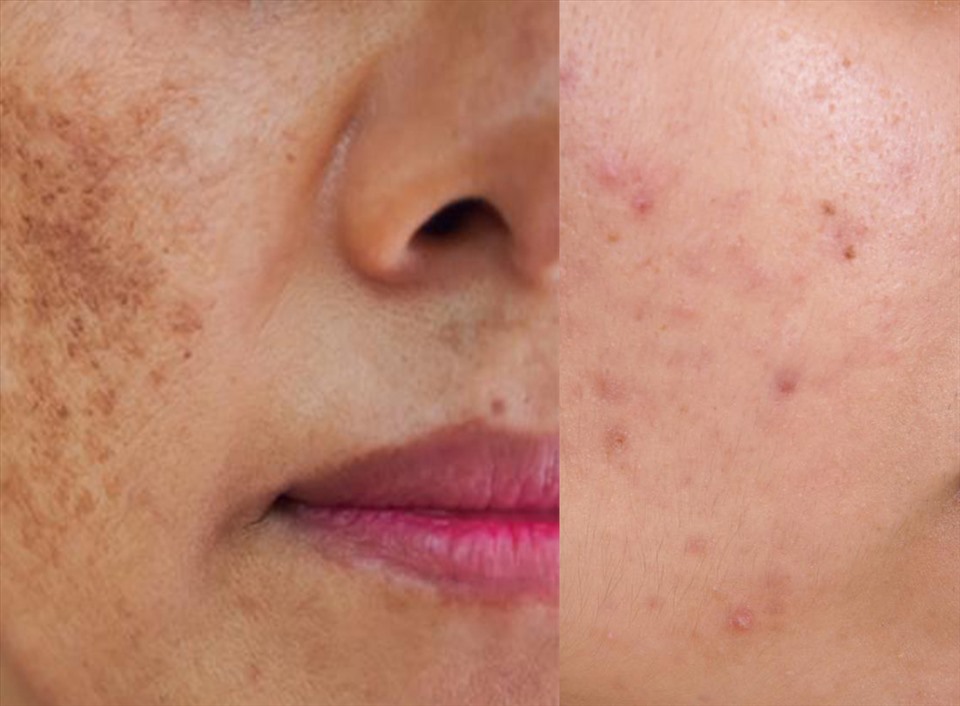 Graphic photo: Van Thang