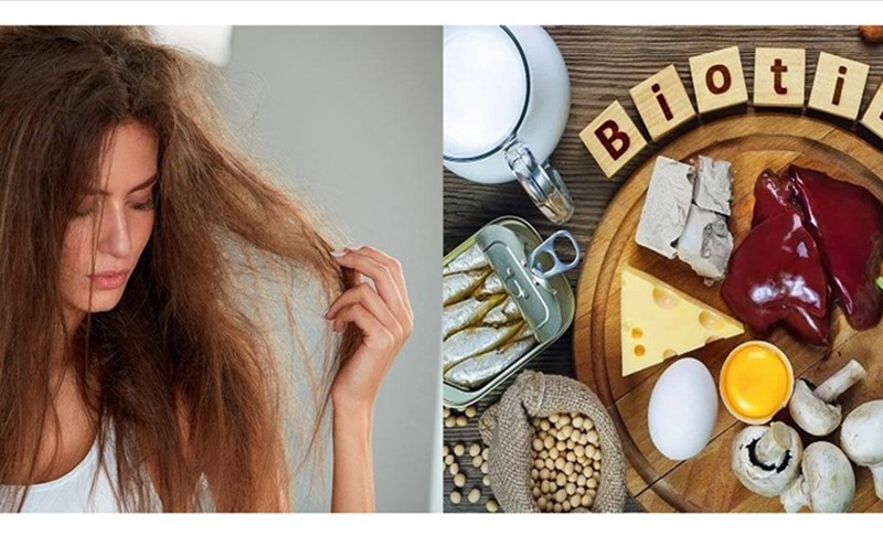 10 thực phẩm giàu biotin tốt cho sức khỏe của da, tóc và chức năng não