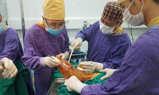 Các bác sĩ Bệnh viện Hữu nghị Việt Đức phẫu thuật cho bệnh nhân. Ảnh; BVCC