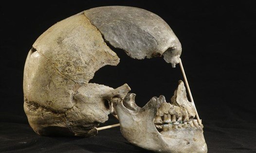 Hộp sọ người phụ nữ cổ đại được gọi là  Zlatý kůň. Ảnh: Viện Max Planck.