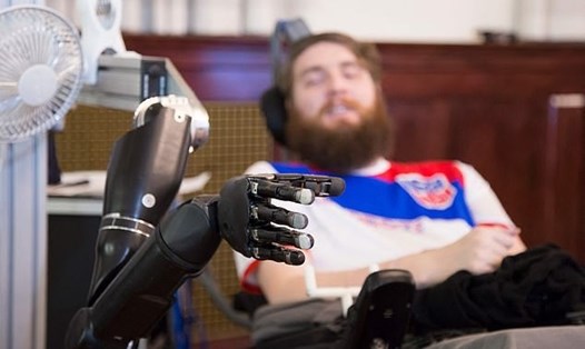 Nathan Copeland (trong ảnh) có các điện cực trong vỏ não vận động và cảm giác, cho phép anh ta điều khiển một cánh tay robot và cảm nhận những gì bàn tay kim loại này đang chạm vào. Ảnh: UPMC/Pitt Health Sciences/AFP