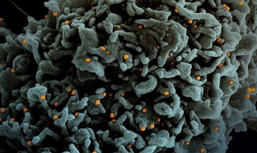 Ảnh một tế bào (màu nâu) bị nhiễm virus SARS-CoV-2 (màu cam) biến thể B.1.1.7 phát hiện lần đầu ở Anh. Ảnh: NIAID/AFP