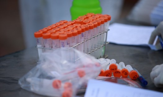 Mẫu xét nghiệm SARS-CoV-2 được lấy ngày 8.5 tại Hà Nội. Ảnh: Hải Nguyễn
