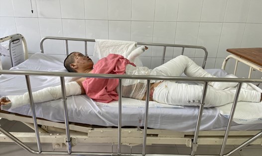 Chị Nhung vừa trải qua một cuộc phẫu thuật tại Bệnh viện Chợ Rẫy (TP. HCM). Ảnh: GĐCC