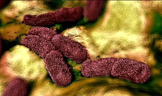 Chủng vi khuẩn Yersinia pestis gây ra đại dịch cái chết đen thế kỷ 14 được tìm thấy trong bộ hài cốt 5.000 năm tuổi. Ảnh: Đại học Kiel