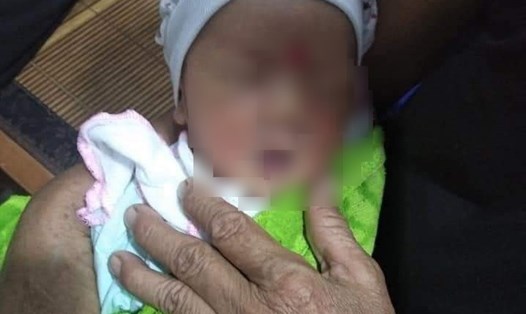 Bé trai sơ sinh khoảng 3 ngày tuổi ở Thái Bình bị bỏ rơi ven vệ đường. Ảnh: CTV.