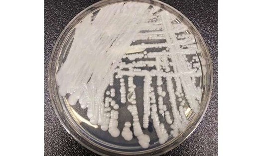 Nấm Candida auris, một loại nấm siêu vi khuẩn có hại, gây kháng thuốc và hiện chưa có phương pháp điều trị. Ảnh: CDC Mỹ