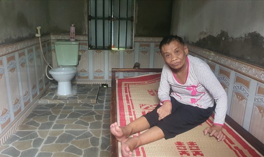 Bà Ngô Thị Thoa (54 tuổi) - em gái bà Ngô Thị Dung ở thôn Linh Thanh, xã Thuần Thành (huyện Thái Thụy, Thái Bình) là nạn nhân chất độc da cam dioxin. Ảnh: T.D