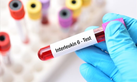 WHO khuyến nghị sử dụng interleukin-6 điều trị cho bệnh nhân COVID-19 nặng. Ảnh: AFP/Getty