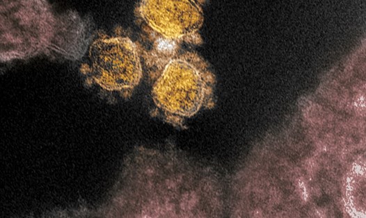 Virus SARS-CoV-2 phân lập từ tế bào cơ thể của bệnh nhân COVID-19 ở Mỹ. Ảnh minh họa. Ảnh: AFP