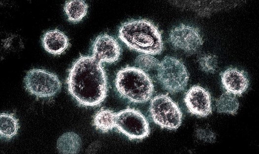 Virus SARS-CoV-2 trong tế bào cơ thể người mắc COVID-19. Ảnh: AFP