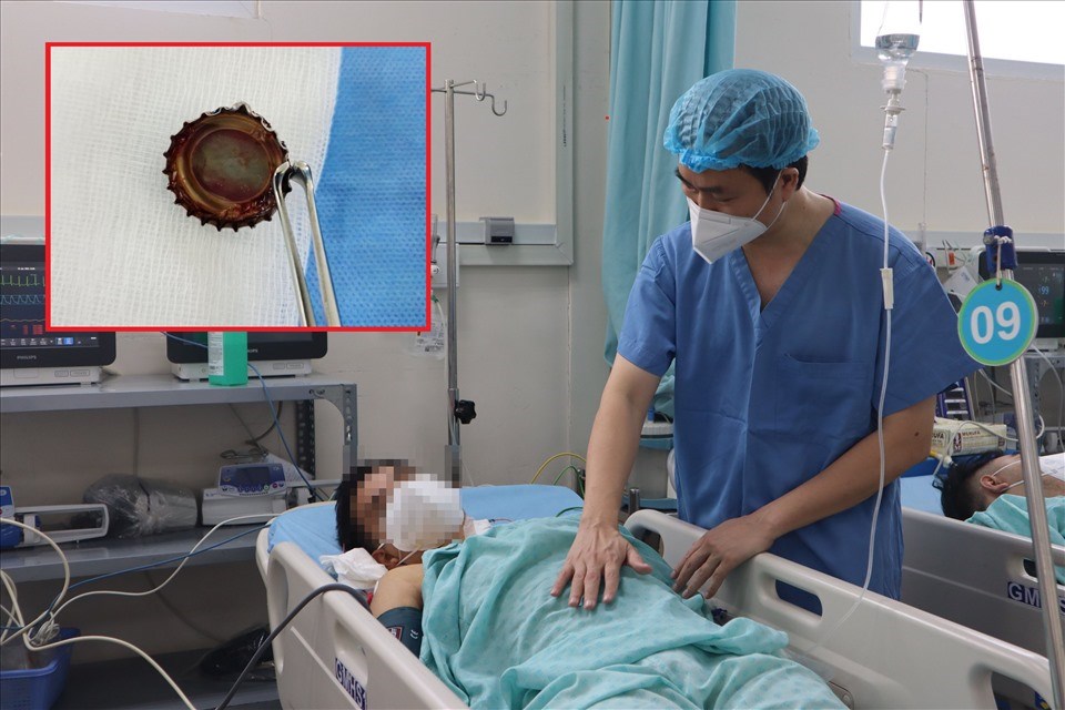 Phẫu thuật lấy nắp chai kim loại cắm sâu hơn 2 tháng trong thực quản. Ảnh: BV Phẫu thuật lấy nắp chai kim loại cắm sâu hơn 2 tháng trong thực quản. Ảnh: BV