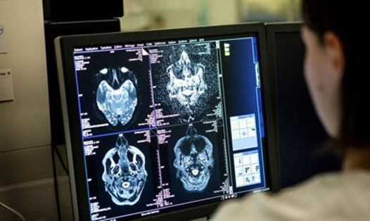 Dịch vụ chẩn đoán hình ảnh y tế tại một bệnh viện ở Savoie, Pháp. Ảnh minh họa. Ảnh: AFP/Getty