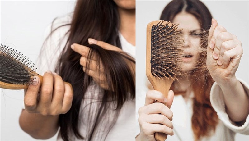 Việc ăn uống và cách chăm sóc tóc có liên quan đến rụng tóc ở tuổi 18 không?
