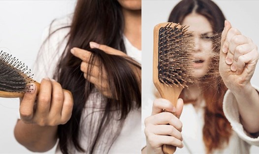 Rụng tóc quá nhiều ở tuổi thiếu niên nên khắc phục như thế nào?