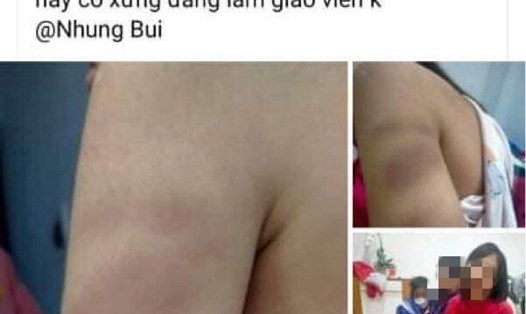 Hình ảnh đăng tải trên mạng xã hội facebook liên quan đến sự việc tại Trường tiểu học Đồng Thái. Ảnh chụp màn hình
