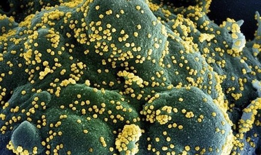 Ảnh minh họa virus SARS-CoV-2 (màu vàng) đang tấn công tế bào trong cơ thể (màu xanh). Ảnh: AFP