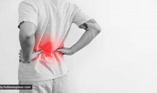 Đau lưng thường liên quan đến co thắt cơ hoặc cứng do viêm xương khớp. Ảnh: Getty Images/Thinkstock