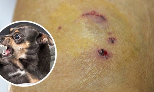 Bệnh dại lây truyền qua nước bọt của động vật mắc bệnh bài tiết ra ngoài và theo vết cắn, vết liếm, vết xước trên da bị rách.