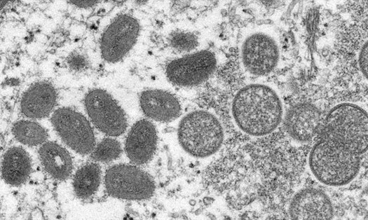 Virus đậu mùa khỉ. Ảnh: CDC Mỹ