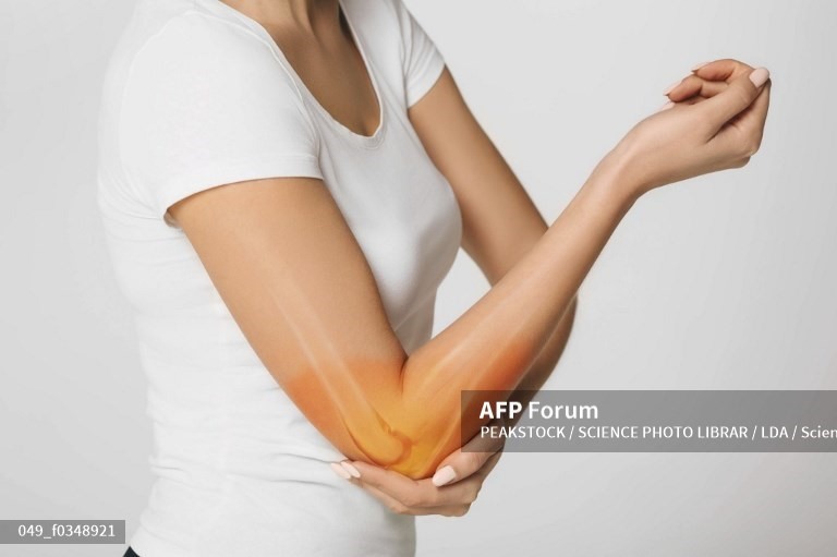 Bác sĩ đưa ra giải pháp cho người cao tuổi thoát khỏi đau nhức xương khớp. Ảnh minh họa: AFP.