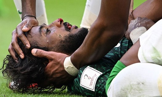 Yasser Al Shahrani của Saudi Arabia sẽ được đưa sang Đức điều trị chấn thương. Ảnh: AFP