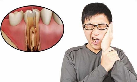 Các bệnh về răng miệng có thể gặp ở bất kì ai và trong mọi lứa tuổi. Ảnh: Hương Giang. Ảnh: Đình Quốc