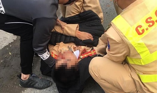 Chiến sĩ cảnh sát bị thương thuộc Đội CSGT huyện Yên Mỹ. Ảnh: Bá Huấn