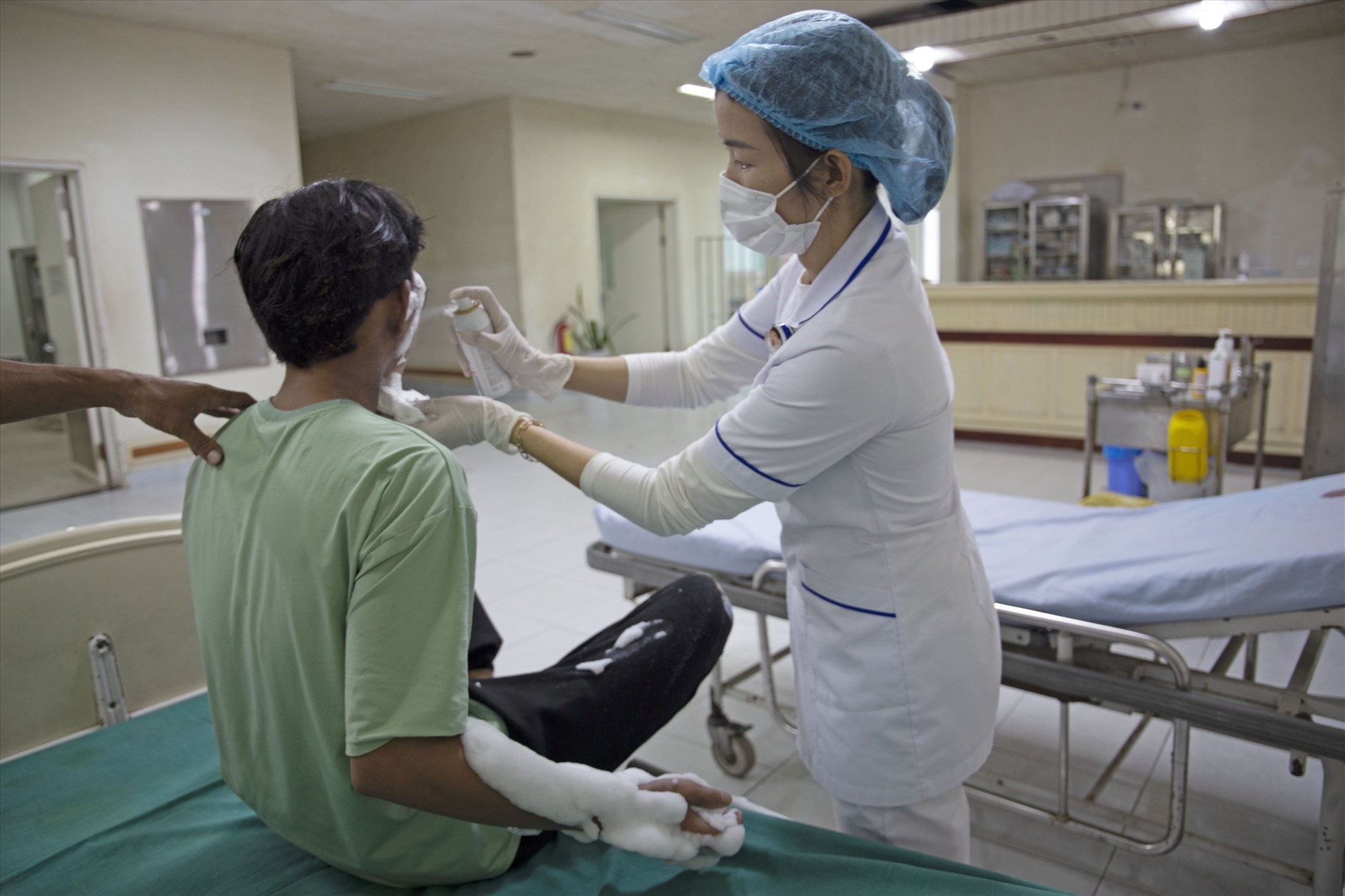 Bệnh nhân bị bỏng nặng do điện thoại cháy nổ khi sạc. Ảnh: L.Phi