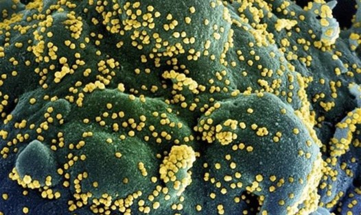 Virus SARS-CoV-2 (màu vàng) tấn công tế bào (màu xanh) trong cơ thể người. Ảnh: AFP