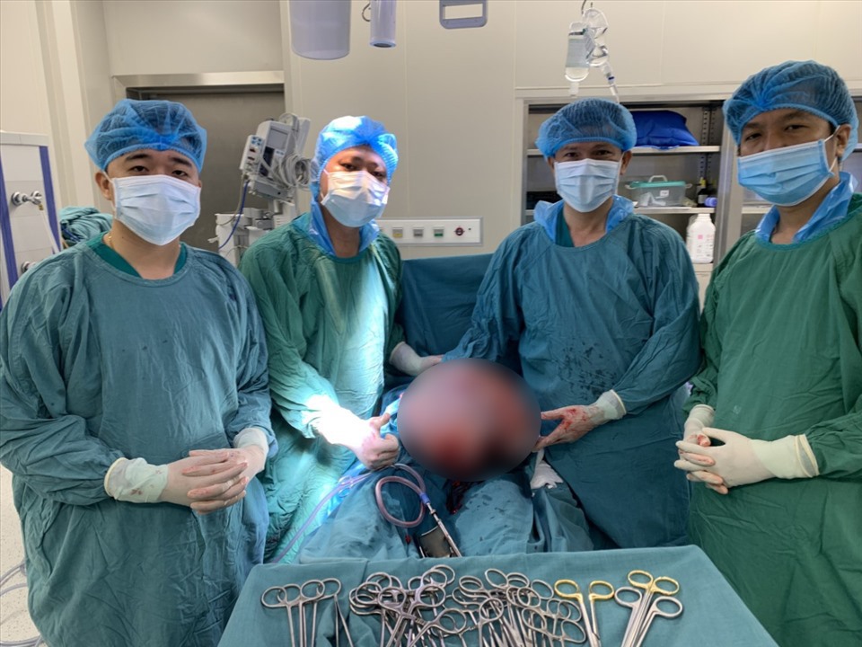 Khối u buồng trứng khổng lồ nặng 13 kg. Ảnh: BV cung cấp