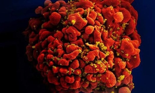 Một biến thể mới với độc lực cao của virus HIV đã được các nhà nghiên cứu của đại học Oxford tìm ra tại Hà Lan. Ảnh: AFP