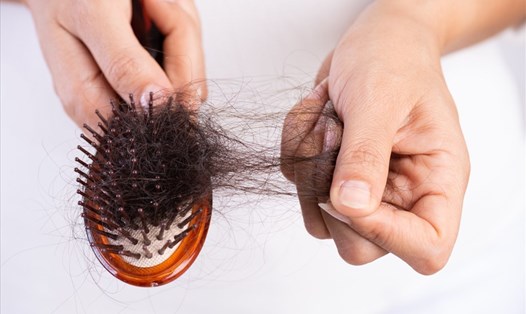 Nhiều người bị rụng tóc sau khi mắc COVID-19. Ảnh minh họa: health.com