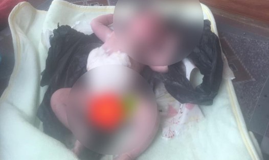 Trẻ sơ sinh bị bỏ rơi bên vệ đường tại xã Xuân Tây. Ảnh: N.C.Mỹ