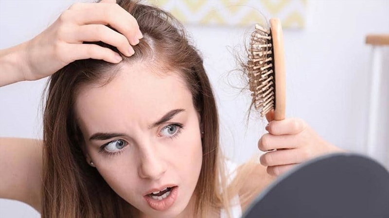Tìm hiểu nguyên nhân rụng tóc nhiều ở nữ và cách phòng tránh