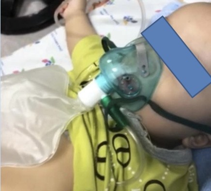 Cứu sống trẻ mắc COVID-19 gây suy hô hấp nặng. Ảnh: BV