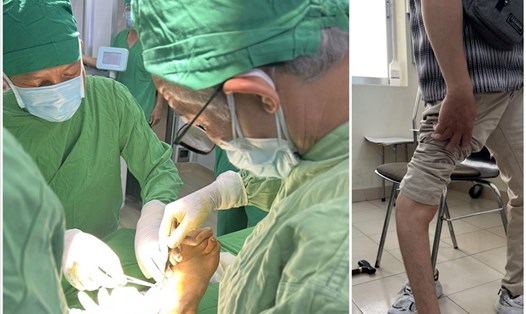 Phẫu thuật thành công cho thanh niên Khánh Hòa bị chân cong vẹo.